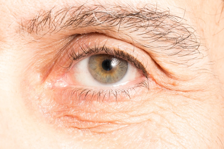 Oog