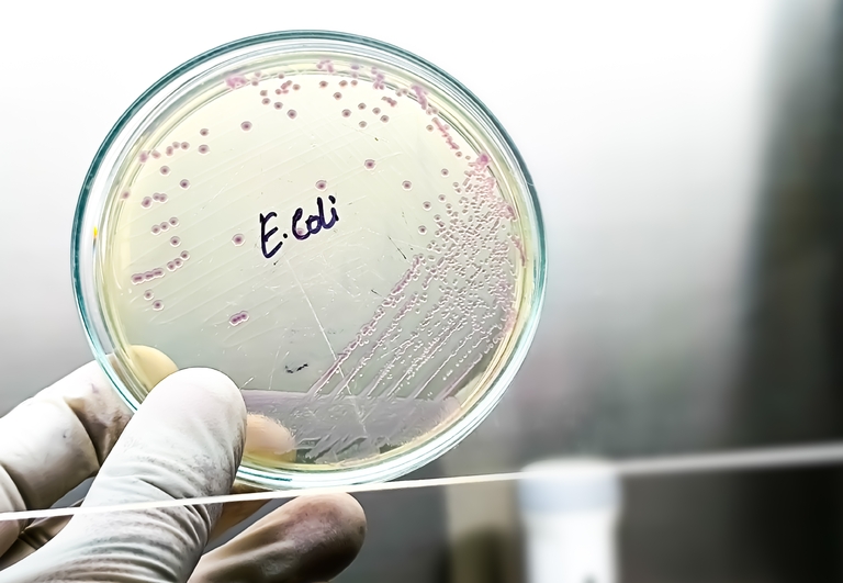 E. coli bacterie